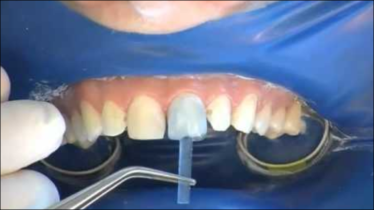 Coltene: Dank Zukäufen Umsatz 2018 um über ein Fünftel gesteigert