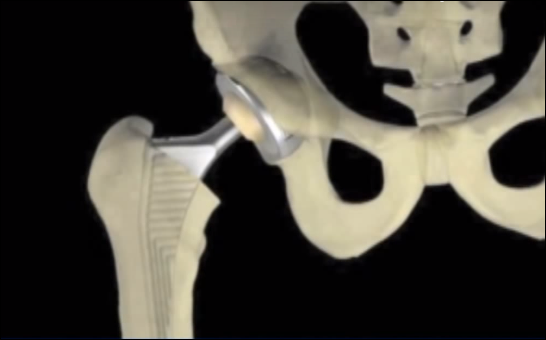 Medacta: Ein innovatives, wachstumsstarkes und profitables Unternehmen