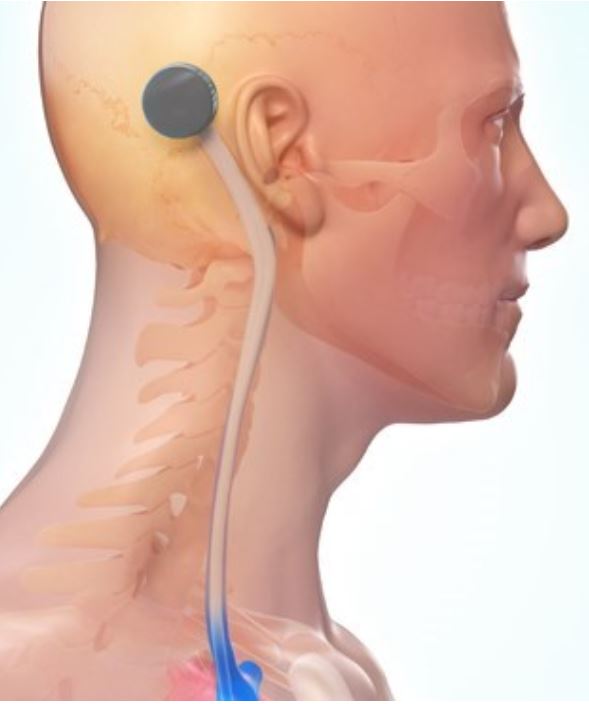 Cendres+Métaux: Kapitalerhöhung bei Tochter Diavantis wird gestoppt